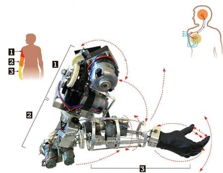 Prosthetic arm