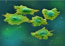Colon cancer cells