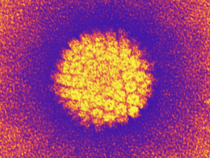 Human papilloma virus (HPV), coloured transmission electron micrograph (TEM).